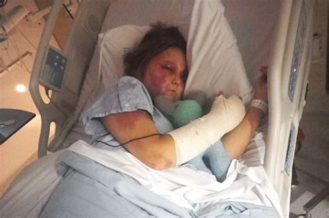 kirra hart now|Teen victim of brutal alleged bashing speaks out。